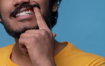 ¿Por qué sangran las encías? Señales de alerta y qué hacer