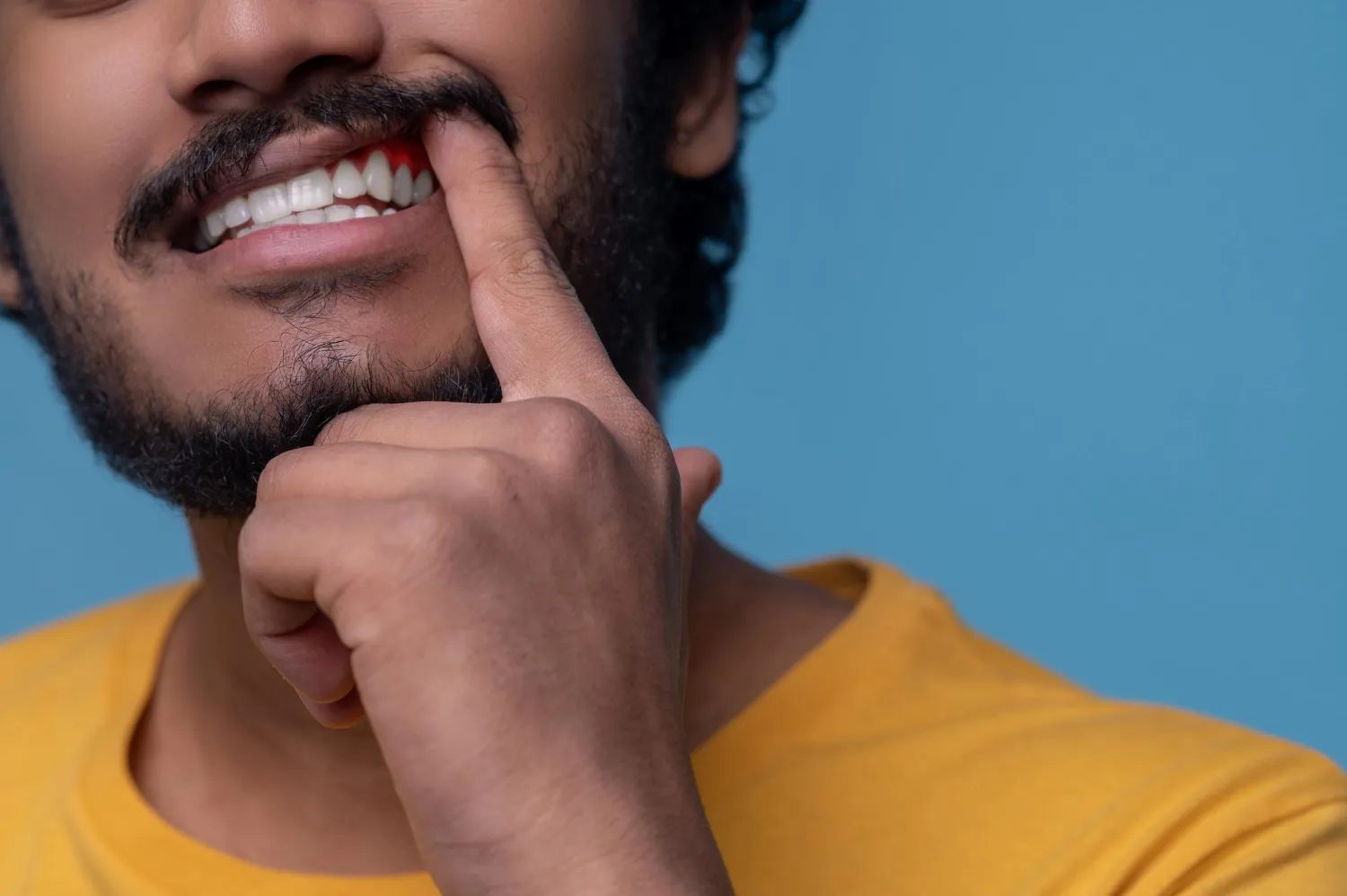 blog por que sangran encias la fabrica de sonrisas